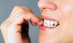 Closeup of patient biting their nails