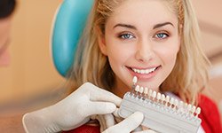 Woman's smile compared with tooth color chart