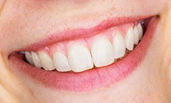Closeup of flawless teeth and gums
