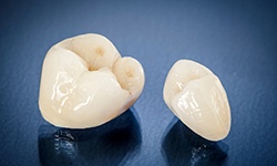 a close-up of metal-free dental crowns