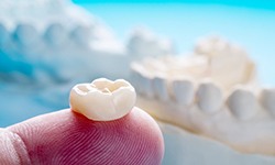 a close-up of a dental crown