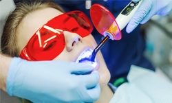 dentist curing a tooth-colored filling