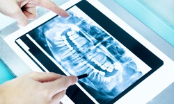 examining dental x-ray